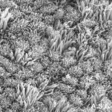 Human endometrium 3 days after ovulation.